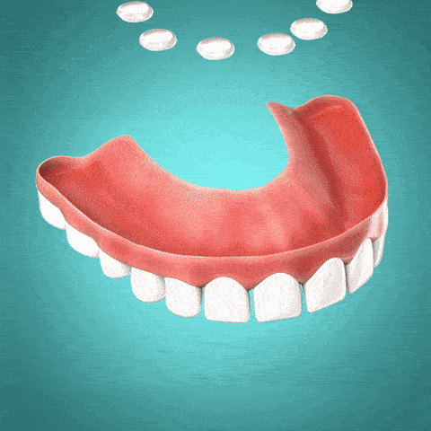 Denture Reline Kit